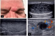 Common applications of noncosmetic dermatologic sonography: A comprehensive overview