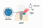 Comparative study of the effect of different exposure parameters of 635nm diode laser and toluidine blue O in eliminating Aggregatibacter actinomycetemcomitans biofilm from titanium implant surfaces