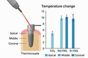 Effect of Various Laser Wavelengths on Temperature Changes During Periimplantitis Treatment: An in vitro Study